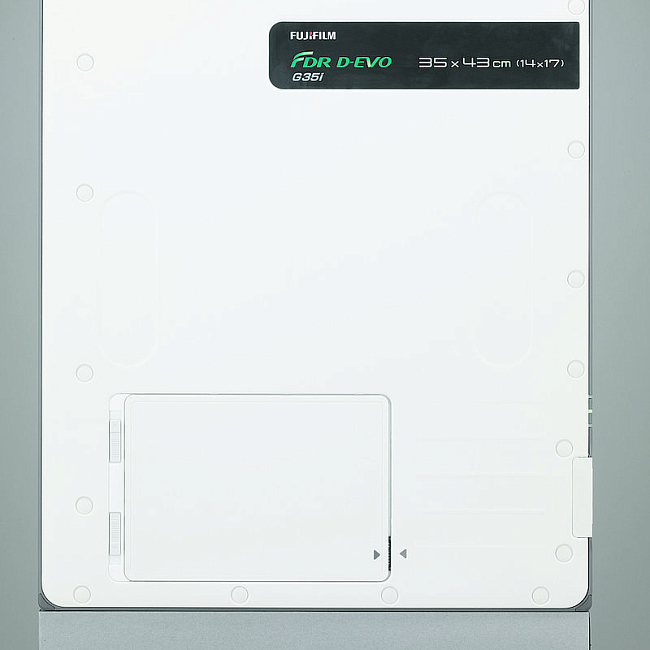 Система цифровой рентгенографии