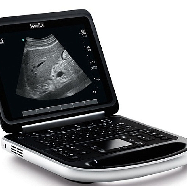 Аппарат ультразвукового сканирования Fujifilm SonoSite EDGE II