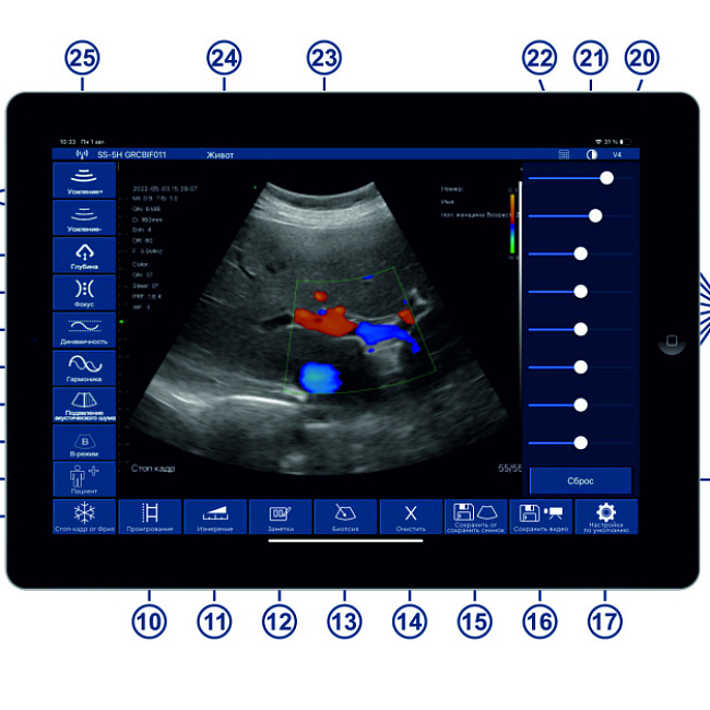 Система ультразвуковая диагностическая ЕЛС500Мини